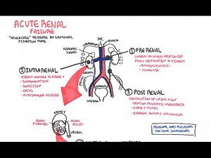 Acute Renal Failure • Video • MEDtube.net