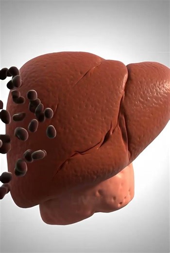 Uveal Melanoma #eyes #facts #science #biology