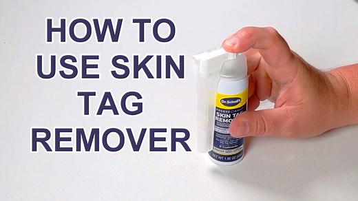 Watch How to Use Skin Tag Remover on Amazon Live