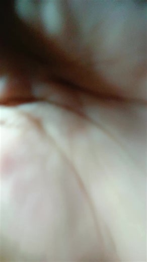 no effect....demoo🤕#Tuvalu #fypp @🌺ŁÏŠHHËŔŘ🌺🇹🇻