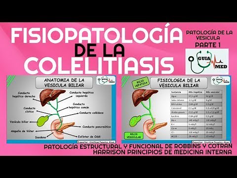 COLELITIASIS FISIOPATOLOGÍA| GuiaMed