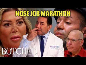 Every Botched Nose Job MARATHON | E!