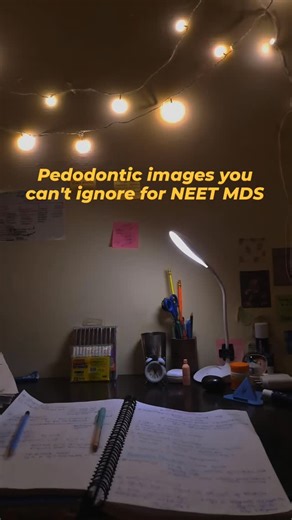 Dr Smiley on Instagram: "Don't let Image-Based Questions (IBQs) take your rank down! 📉 Focus on these key areas: ✅ Space Maintainers (Band & Loop vs. Distal Shoe) ✅ Developmental Anomalies (Taurodontism, Fusion vs. Gemination) ✅ Trauma Classification (Ellis Class I-IV) ✅ Habit Breaking Appliances ​Tag a study buddy who needs to see this! 👯‍♂️ #pedodontics #imagebasedquestions #neetmds2026 #neetmdspreparation #dentmindset"
