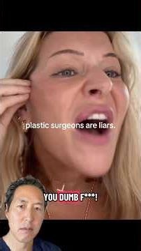 Why Do You Need To Tighten the Muscle During a Facelift?