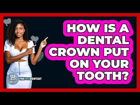 How Is A Dental Crown Put On Your Tooth? - The Pro Dentist