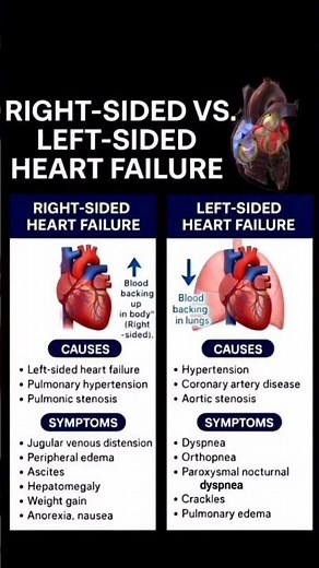 Right sided Vs Left sided heart failure🫀#echocardiography