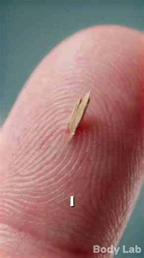 Never Leave A Splinter In Your Skin Here's Why