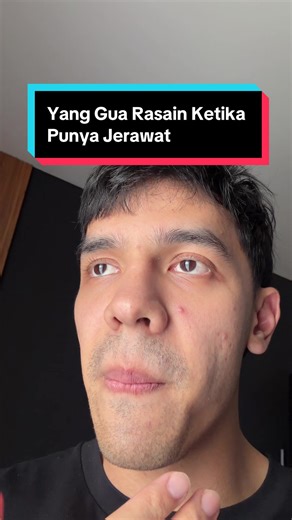 Orang Paling Jelek Sedunia: Masalah Jerawat dan Kecantikan