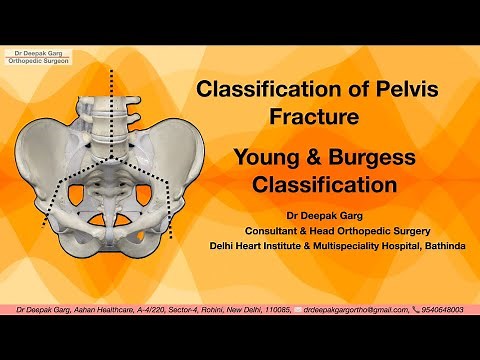 Understanding Pelvic Fracture Classification: Young and Burgess System Explained | Dr Deepak Garg
