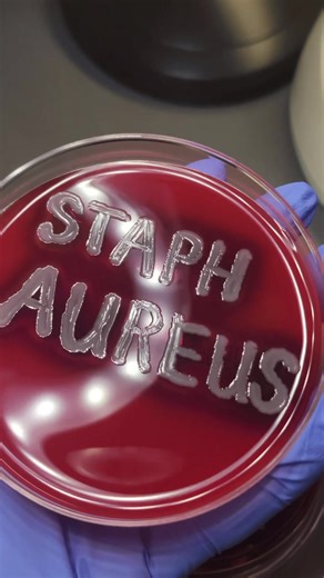 This bacteria is contagious! Especially for grapplers! 👀🥋🤼‍♂️ This petri dish shows an organism that causes staph infections. When your doctor tells you that you have a staph infection, this is what we’re actually seeing and working with in the laboratory. The organism growing here is Staphylococcus aureus, a beta-hemolytic, Gram positive cocci that grows in clusters and is commonly found on the skin, but can cause serious disease once it enters the body. Staph aureus is associated with skin 