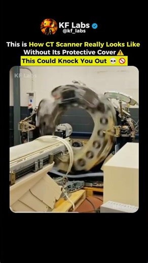 Uncovered CT Scanner | DANGEROUS⚠️😳