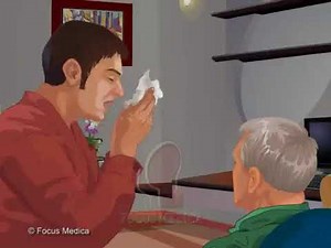 SARS (Severe Acute Respiratory Syndrome)