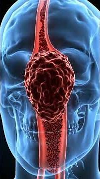 NEVER Pop a Pimple in this "Danger Triangle" ⚠️🔺 #shorts