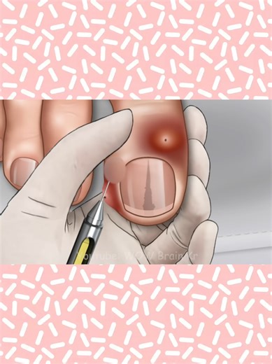 ASMR Treatment⚪️ #DoctorASMR #USAtreatment #BeautyRelaxASMR #CalmingASMR #viralasmr