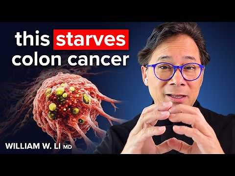 The SHOCKING ROOT CAUSE of Cancer & How To STARVE It! | Dr. William Li