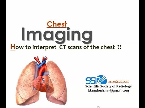 2- CT chest anatomy & techniques - Prof Mamdouh Mahfouz