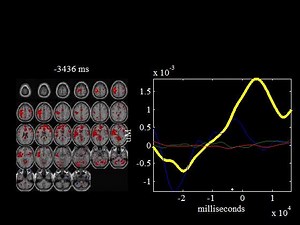 File:Fusion-of-fNIRS-and-fMRI-data-identifying-when-and-where-hemodynamic-signals-are-changing-in-human-Movie1.ogv - Wikimedia Commons