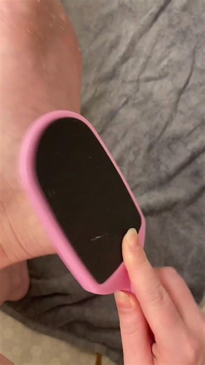 Amazing results with this LOVE, LORI callus remover gel!