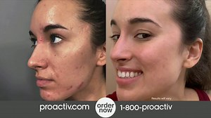ProactivMD TV Spot, 'Turntable Brand Gel Head: Easy to Start'
