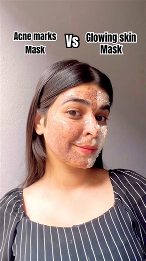 Remove ACNE MARKS using this😍#short#acne#acnemarks#diy#ayurvedicskincare#ricefacemask#redsandalwood