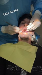 8.6K views · 87 reactions | This sucks... A failed root canal in Uganda led to me getting my tooth extracted... It's all a part of the journey... On Vacation Doctor | 2Up and Overloaded | Facebook