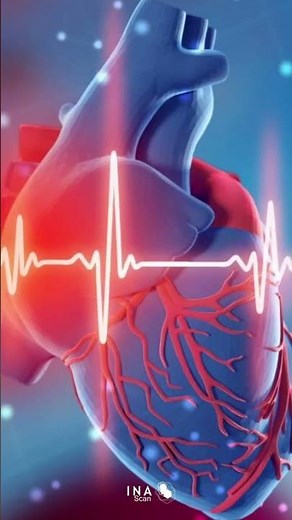 SPECT de Perfusión Miocárdica para el diagnóstico de enfermedades cardiovasculares