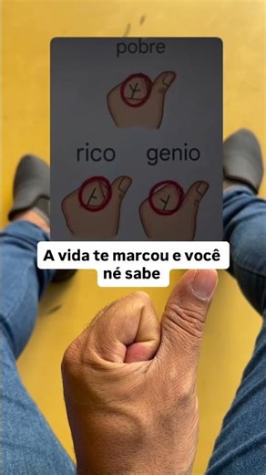 Life has marked you and you didn't know it, what mark has marked yours? #trend #viral #fypシ