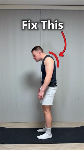 Stretching Exercises to Fix Forward Head Posture