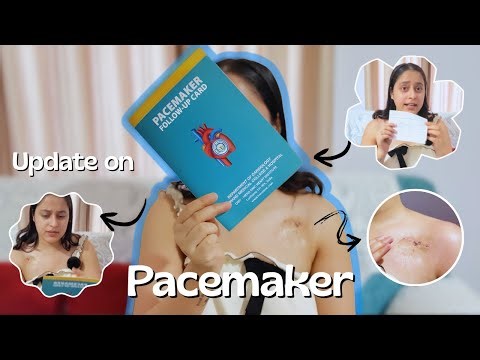 First Pacemaker Checkup : What Doctor Told Me Today