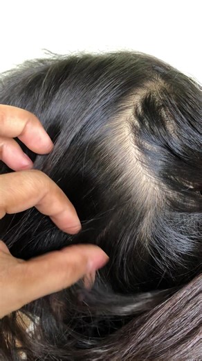 #edit #goviral #lice #humor #f