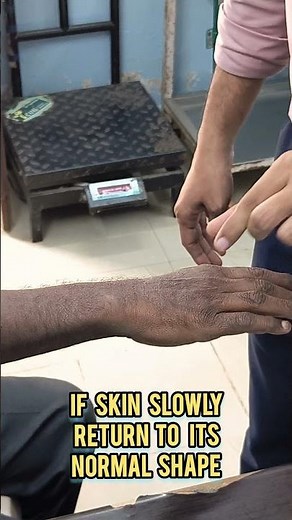 How to check skin turgor test #shorts #skincare