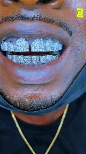 Diamond Teeth 😬 Style নাকি Danger? | Teeth Facts Bangla #shorts