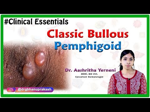 Classic bullous pemphigoid (Clinical essentials): Dr. Aashritha yerneni