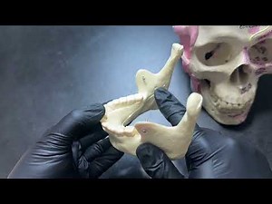 Inferior Alveolar (IA) Nerve Block On Skull