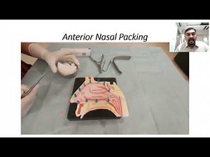 Anterior Nasal Packing for Epistaxis