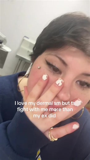 Understanding Dermal Piercings: Personal Insights