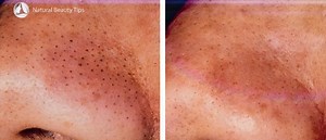 93K views · 2.2K reactions | DIY BEST PEEL OFF FACE MASK | Organic Beauty Tips | Facebook