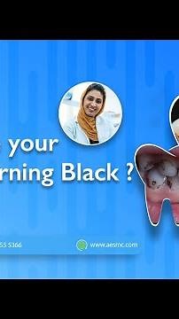 Why Are Your Teeth Turning Black or Brown❓Learn About Chromogenic Bacteria! #dentalhealth #dental