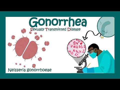 Gonorrhea: Signs & Symptoms | Neisseria gonorrhoeae | Diagnosis and Treatment of Gonorrhea | USMLE