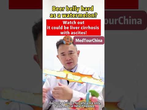 "Beer Belly ≠ Just Fat! 🍺⚠️"