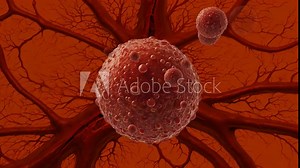 A tumor emerges from a ruptured blood vessel, with similar tumors bursting out. This animated scene vividly illustrates the aggressive spread of cancer cells from damaged vascular tissue