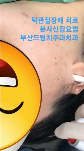 턱관절장애 턱에서 딱딱 소리가 나요 물리치료 운동치료 분사신장요법 (부산 드림치주과치과 전문의)