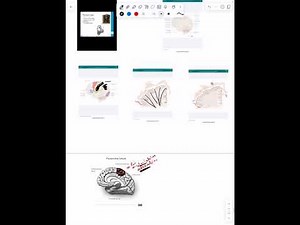Anatomical localization of neurological lesions - Part 2