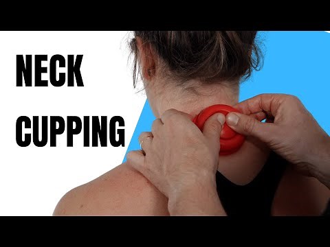 Dry Cupping Techniques for Neck Pain