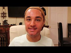 50% Glycolic acid peel (Platinum Skin Care).