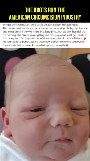 Greed, pride and power fuel the genital #circumcision industry in American hospitals. | Brother K