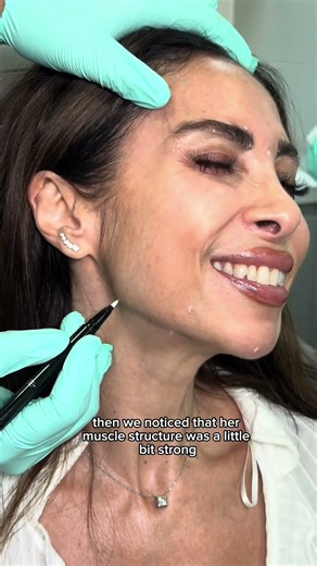 Results from this to this 😳 Stay till the end to see the transformation | DRMEDISPA