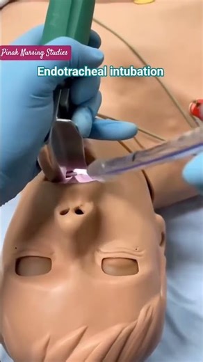 Endotracheal intubation
