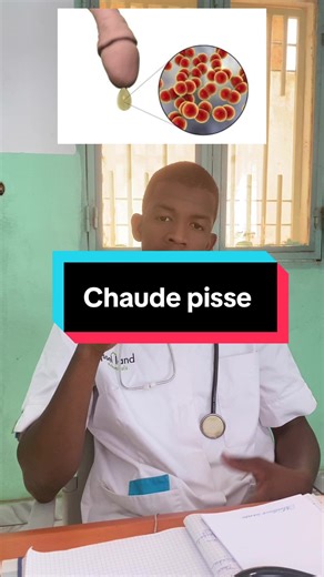 La blennorragie gonococcique (« chaude-pisse ») est une infection sexuellement transmissible (IST) fréquente, causée par la bactérie Neisseria gonorrhoeae. Elle provoque des brûlures en urinant et des écoulements purulents (verge, vagin, anus). Le traitement repose sur des antibiotiques, mais la résistance augmente.