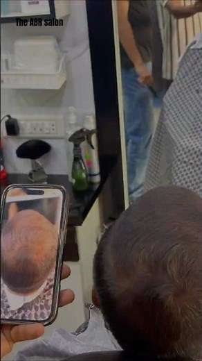 HOW TO COVER A BALD SPOT IN SECONDS? 😳 💯 INSTANT HAIR COVER ✂️